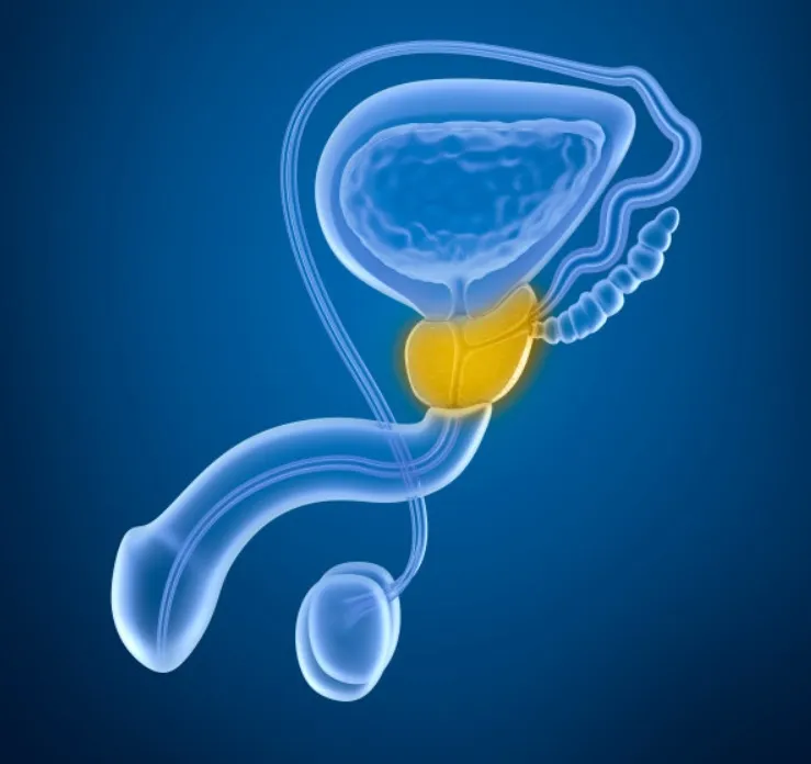 攝護腺：男性健康的守護者－三種方法保護攝護腺