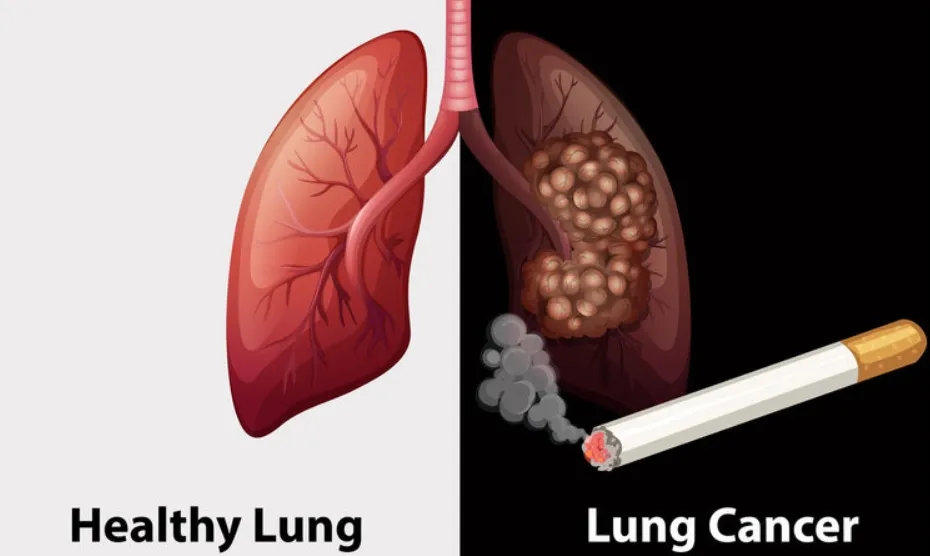 為什麼長年吸菸者卻未罹患肺癌？國外研究揭示原因